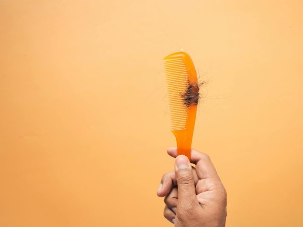 Rambut Gugur Teruk? Cara Atasinya Dengan Nutrisi Yang Betul